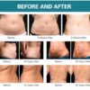 Advanced Cryo Machine: Sculpting & Fat Reduction Device - Image 2