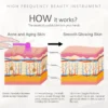 Portable High-Frequency Electrotherapy Wand: Anti-Aging & Acne Treatment - Image 3