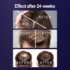 Advanced Laser Hair Growth Cap: Combat Hair Loss & Boost Follicle Health - Image 4