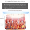 Portable UV Phototherapy: Targeted Relief for Vitiligo, Psoriasis, Eczema - Image 3