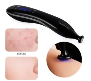 Blue Light Ozone Acne Treatment Machine Cold Plasma Skin Rejuvenation Plasma Pen for Acne Scar Wrinkle Removal jato de plasma