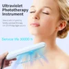 Portable UV Phototherapy: Targeted Relief for Vitiligo, Psoriasis, Eczema - Image 2