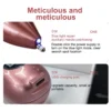Advanced Microcomputer Control Skin Tag & Spot Remover: Clearer Skin, Pain-Free - Image 2