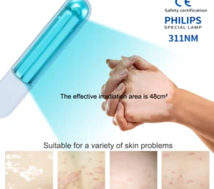 Portable UV Phototherapy: Targeted Relief for Vitiligo, Psoriasis, Eczema