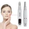 Picosecond Laser Pen: Advanced Tattoo, Spot, Mole Removal for Clearer Skin - Image 2